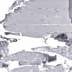 Immunohistochemical staining of human skeletal muscle shows no positivity in myocytes as expected.