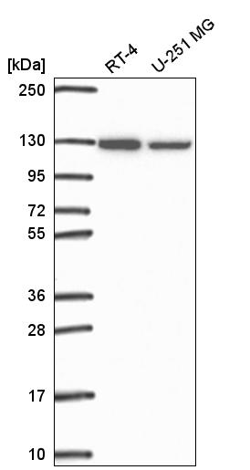 Anti-SRRT Antibody