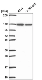 Anti-SRRT Antibody