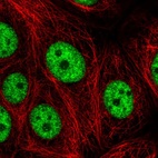 Immunofluorescent staining of human cell line MCF7 shows localization to nucleoplasm.