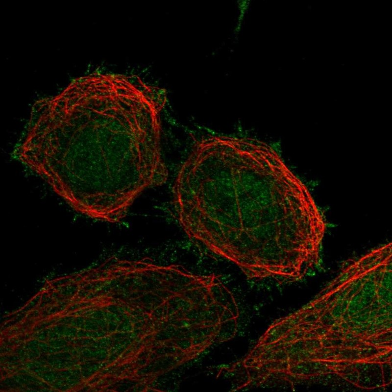Anti-FBXO41 Antibody