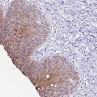 Anti-ZFP64 Antibody