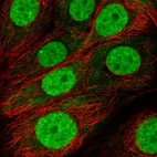 Immunofluorescent staining of human cell line MCF7 shows localization to nucleoplasm & cytosol.