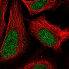 Immunofluorescent staining of human cell line U-2 OS shows localization to nucleus.