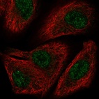 Anti-TOX2 Antibody