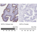 Anti-SNTN Antibody