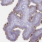 Immunohistochemical staining of human fallopian tube shows strong positivity in cilia in glandular cells.
