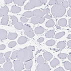 Immunohistochemical staining of human skeletal muscle shows negative cytoplasmic positivity in myocytes as expected.