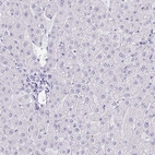 Immunohistochemical staining of human liver shows negative cytoplasmic positivity in hepatocytes as expected.
