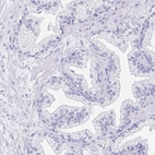 Immunohistochemical staining of human prostate shows negative cytoplasmic positivity in glandular cells as expected.