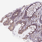 Anti-TMEM71 Antibody