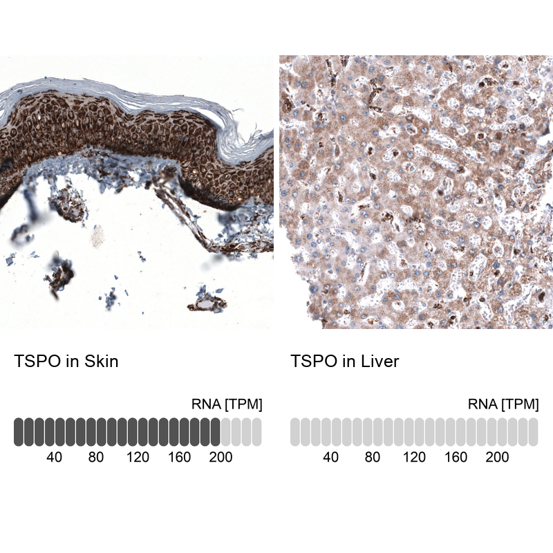 Anti-TSPO Antibody