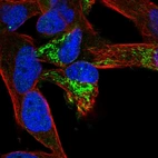 Immunofluorescent staining of human cell line RH-30 shows localization to mitochondria.