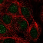 Immunofluorescent staining of human cell line MCF7 shows localization to nucleus.