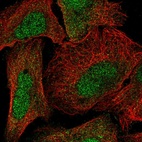 Anti-NTMT1 Antibody