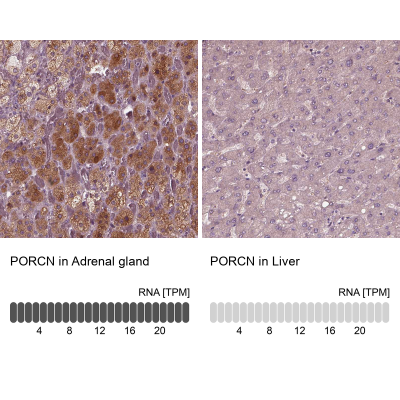 Anti-PORCN Antibody