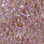 Immunohistochemical staining of human adrenal gland shows strong cytoplasmic positivity in glandular cells.