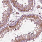 Immunohistochemical staining of human testis shows moderate cytoplasmic positivity in Sertoli cells.