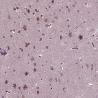 Immunohistochemical staining of human cerebral cortex shows moderate cytoplasmic positivity in neuronal cells.