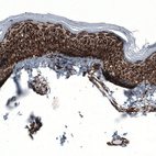 Immunohistochemical staining of human skin shows strong granular cytoplasmic positivity in squamous epithelial cells.