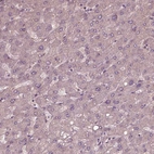 Immunohistochemical staining of human liver shows no cytoplasmic positivity in hepatocytes as expected.