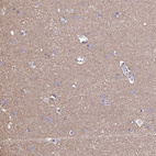 Anti-LIX1 Antibody