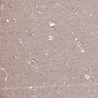 Anti-LIX1 Antibody