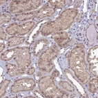 Immunohistochemical staining of human kidney shows moderate cytoplasmic positivity in cells in tubules.