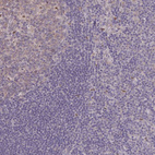 Anti-LIX1 Antibody