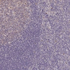 Immunohistochemical staining of human tonsil shows weak cytoplasmic positivity in germinal center cells.
