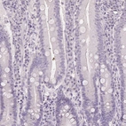 Immunohistochemical staining of human small intestine shows no positivity in glandular cells as expected.