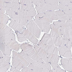 Immunohistochemical staining of human skeletal muscle shows no positivity in myocytes as expected.