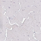 Immunohistochemical staining of human skeletal muscle shows no positivity in myocytes as expected.
