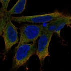 Immunofluorescent staining of human cell line AF22 shows localization to cytosol.