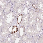 Immunohistochemical staining of human kidney shows strong membranous positivity in cells in tubules.