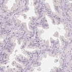 Anti-FXYD4 Antibody