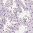 Immunohistochemical staining of human prostate shows no positivity in glandular cells as expected.