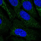 Anti-IDNK Antibody