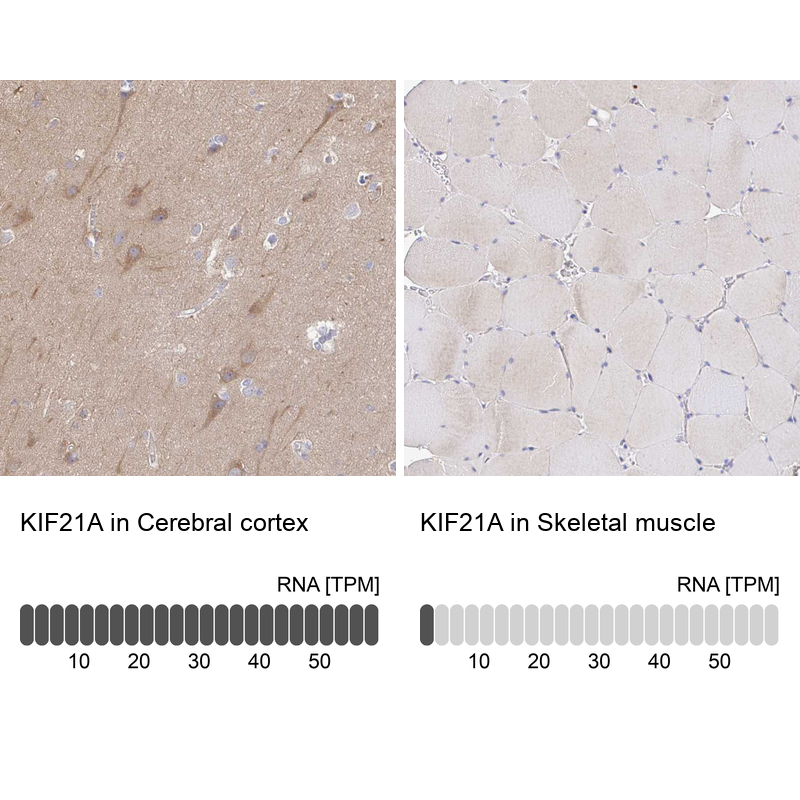 Anti-KIF21A Antibody