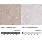 Anti-KIF21A Antibody