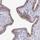Immunohistochemical staining of human fallopian tube shows strong cytoplasmic and moderate luminal membranous positivity in a subset of glandular cells.