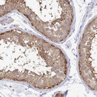 Immunohistochemical staining of human testis shows strong cytoplasmic positivity in a subset of cells in seminiferous ducts.
