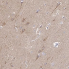 Immunohistochemical staining of human cerebral cortex shows moderate cytoplasmic positivity in neurons.