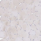 Immunohistochemical staining of human skeletal muscle shows weak positivity in myocytes.