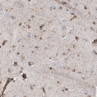 Immunohistochemical staining of human cerebral cortex shows moderate granular cytoplasmic positivity in astrocytes.