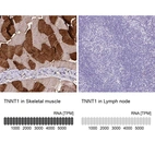 Anti-TNNT1 Antibody