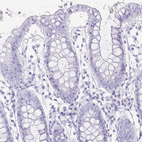 Anti-TNNT1 Antibody