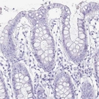 Immunohistochemical staining of human colon shows no positivity as expected.