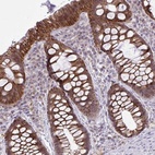 Anti-CYP20A1 Antibody