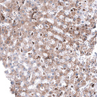 Anti-TSPO Antibody